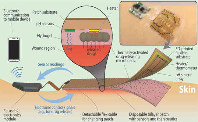 Wirelessly-controlled bandage to heal chronic wounds