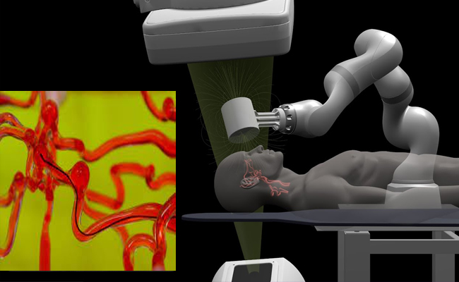 MIT engineers developed joystick-operated robot to treat stroke remotely